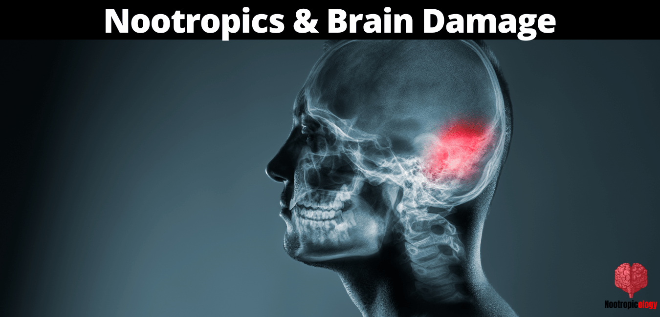 nootropics brain damage